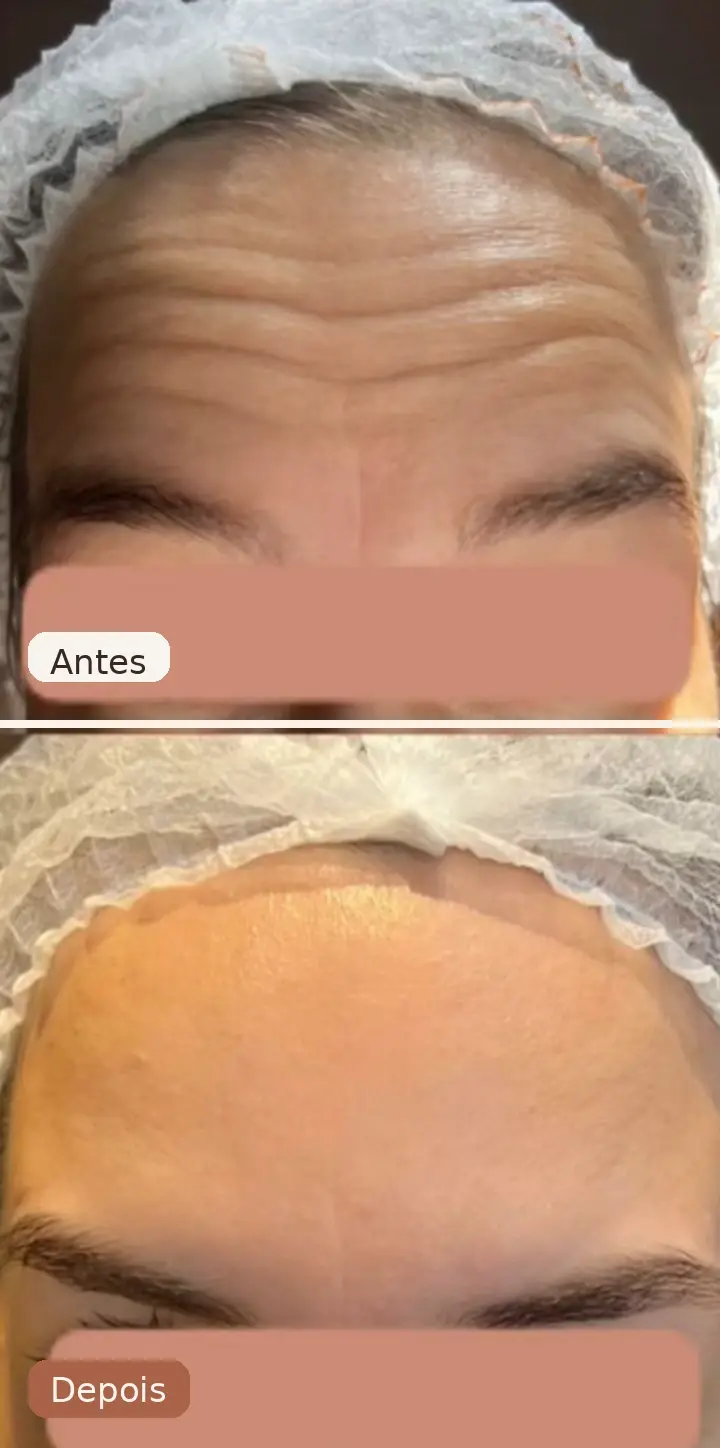 Resultado de tratamento realizado na Clínica Juliana Ribeiro 3