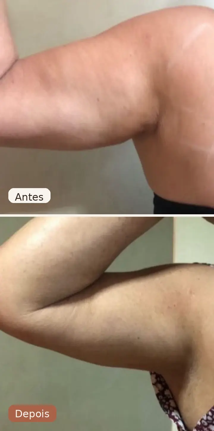 Resultado de tratamento realizado na Clínica Juliana Ribeiro 6